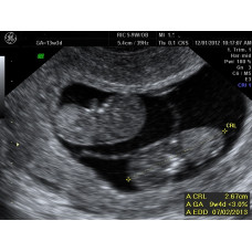 OB/GYN Ultrasound (5 Days)