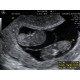 OB/GYN Ultrasound (3 Days)