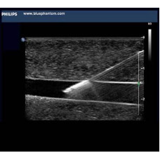 Ultrasound Guided Vascular Access for Nurses