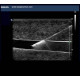Ultrasound Guided Vascular Access