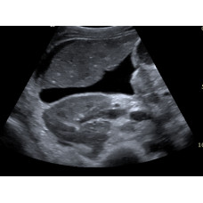 Primary Care/Abdominal Ultrasound (3 Day)