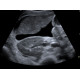 Abdominal Ultrasound (3 Day)